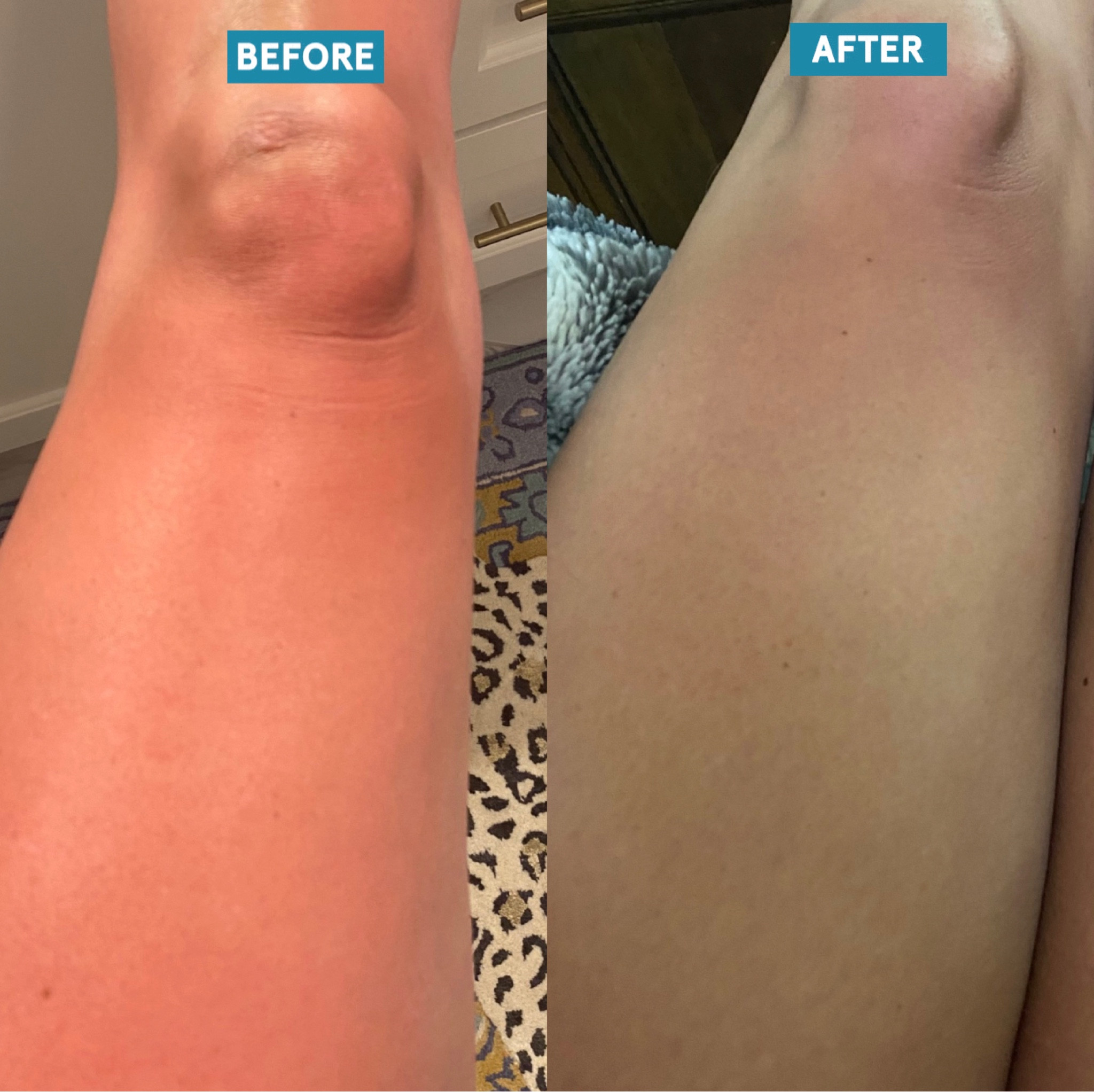 I might have over done it on the ☀️ yesterday at the lake but this all over ointment (designed for kids) saved my skin! One of the best purchases we’ve made! 

#LTKkids #LTKfamily #LTKbeauty