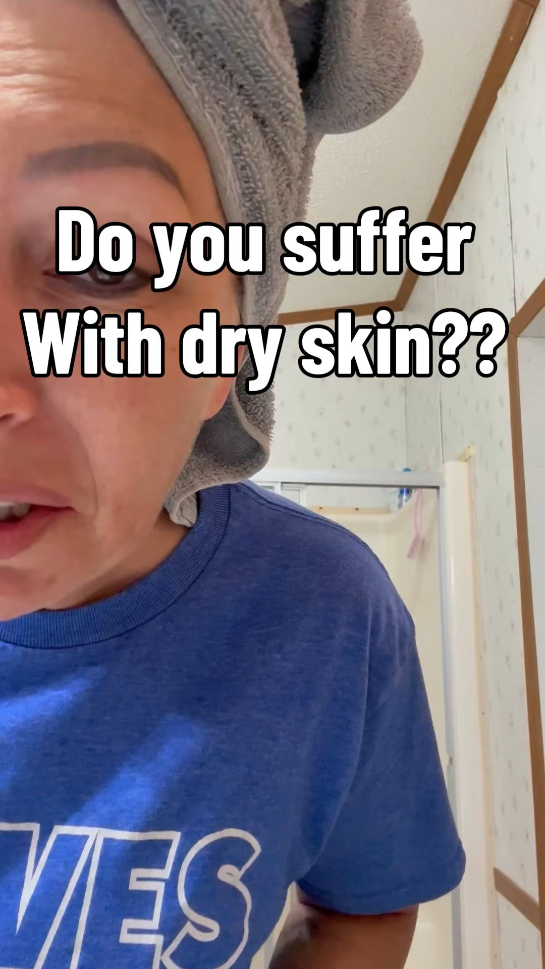 My skin is so dry and this has helped me so much! I have been using WNP for a couple of years now!

#LTKdayinmylife #LTKselfcare #LTKBeauty