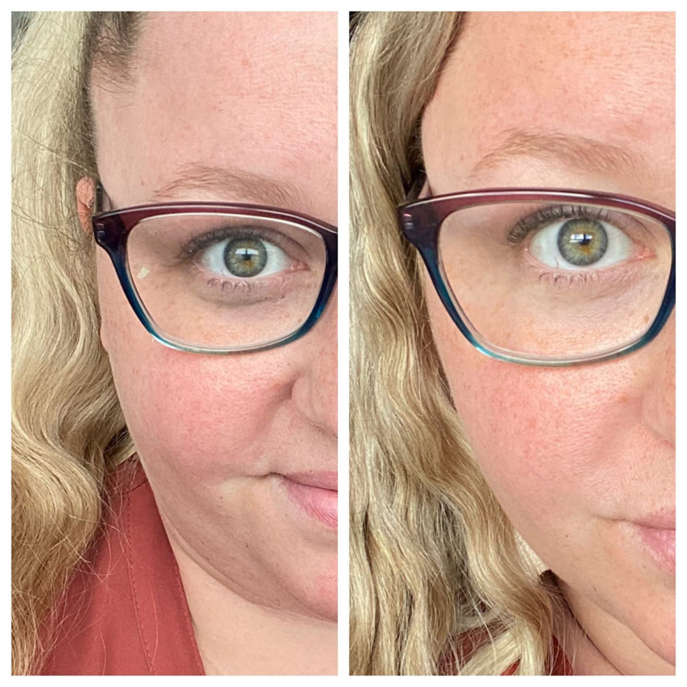 Collagen Boosting Eye Mask Patches Under Eye Patches for Puffy Eyes Hyaluronic Acid Dark Circles ... | Amazon (US)