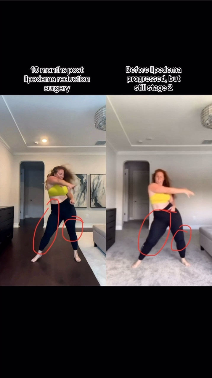 They don’t make my lululemon align leggings with the exact peloton logo as I’m wearing here anymore, but these are the same leggings as far as material cut! If you want a more affordable option, the crz leggings are great!!!!!!! Size 12 in the aligns and XL for the Amazon dupes! Sports bra is an XL.

#LTKFitness #LTKMidsize #LTKWatchNow