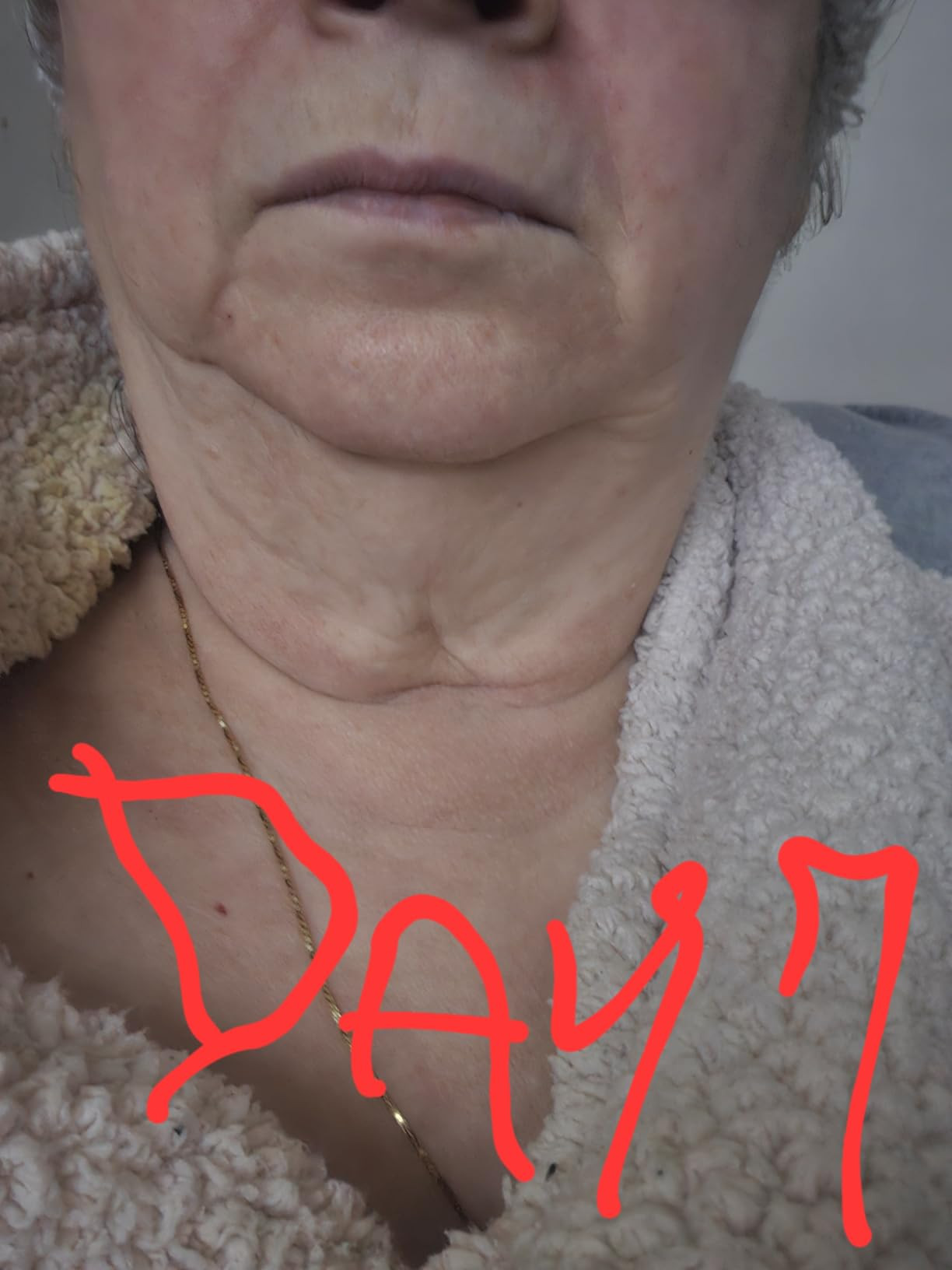 goPure Tighten and Lift Neck Cream- Clinically Tested | Amazon (US)