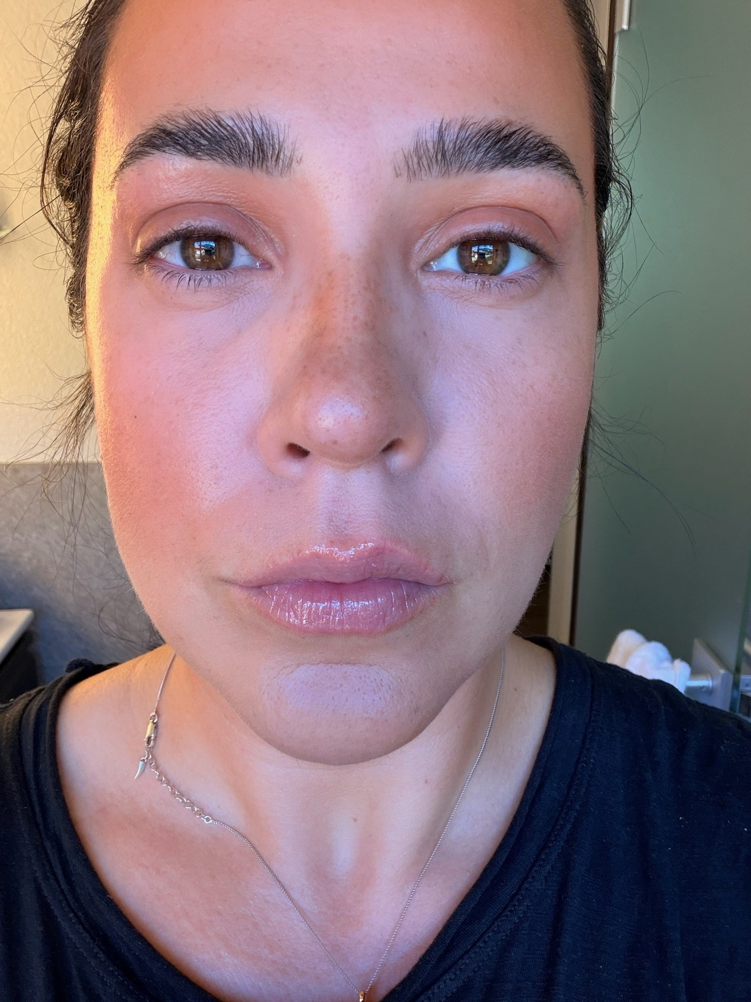 This allergy season has been the worse and my eyes have been so itchy dry irritated and red. These drops instantly hydrate and whiten my eyes for the best relief and look!

#LTKSeasonal #LTKBeauty