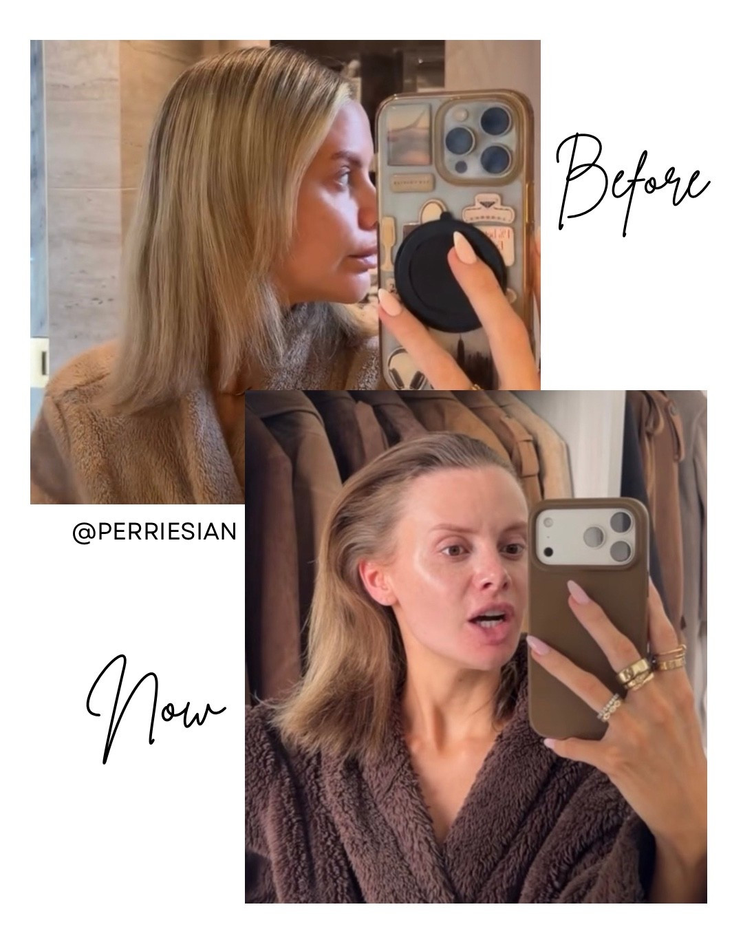 I’m on a real hair journey at the moment and here I’ve linked the products I’ve been using + supplements I’ve been taking which have really been helping me grow my hair and get it in a much better condition!! The picture shows my hair before I started this journey vs now!! I honestly see such a difference 🥹🥹 My hair was so damaged before due to excessive heat, bleach and extensions but it feels and looks so much healthier now!!

The supplements are quite new in my routine but I’ll keep you updated on how I get on with them - I’m also taking Glowwa supplements but can’t link those 🤍

#LTKeurope #LTKbeauty #LTKuk