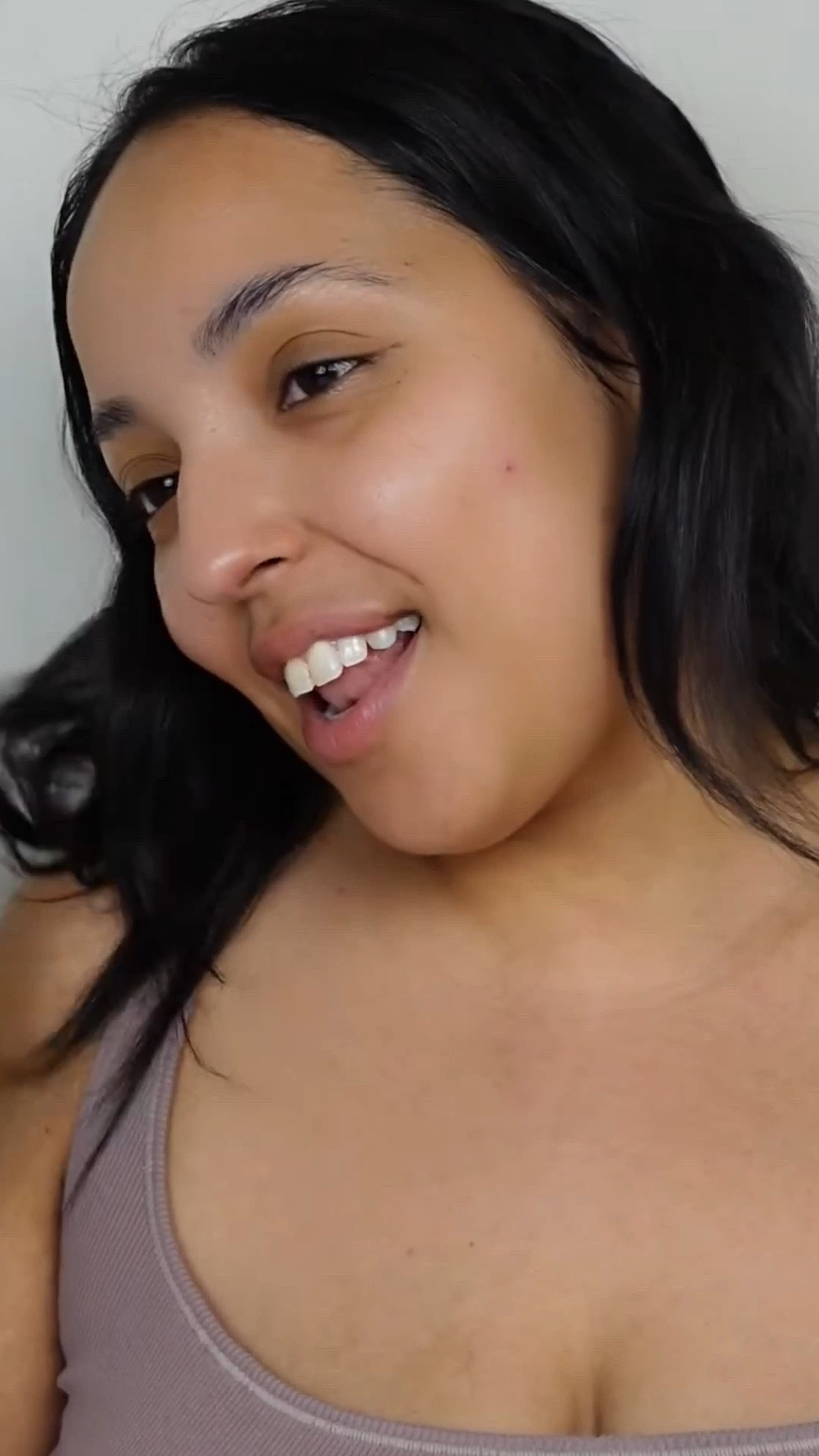 🌟 Post-Blemish Recovery 101:

- Prep with Acne Patches: Before applying any post-blemish products, use acne patches to target and treat the blemish effectively.
  
- Use Benzoyl Peroxide or Salicylic Acid: Incorporate benzoyl peroxide or salicylic acid into your skincare routine to help prevent future breakouts and keep pores clear.

- Introducing Rescue Balm: Hero Cosmetics' Rescue Balm is a game-changer for post-blemish care. 

- Soothe and Heal: This gentle formula helps soothe inflammation and accelerate the skin's natural healing process.

- Reduce Redness: Say goodbye to post-blemish redness with the calming properties of Rescue Balm.

- Nourish Your Skin: Provide your skin with the nourishment it needs to recover fully and maintain a healthy complexion.

By following these simple steps, incorporating benzoyl peroxide or salicylic acid, and using Rescue Balm, you can ensure smooth, radiant skin post-blemish. 🌟 

#LTKVideo #LTKbeauty