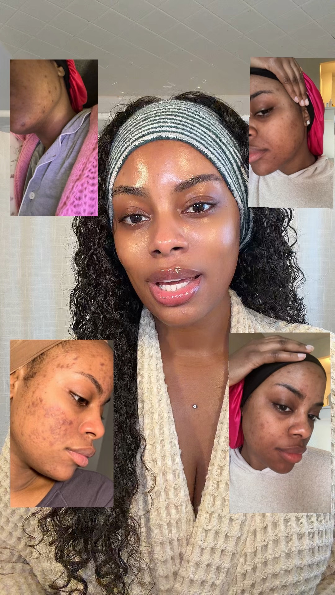 My skincare routine 🫧 #skincareroutine #skincaretips #acneproneskin #acnetreatment #glassskin

#LTKBeauty #LTKgrwm #LTKselfcare