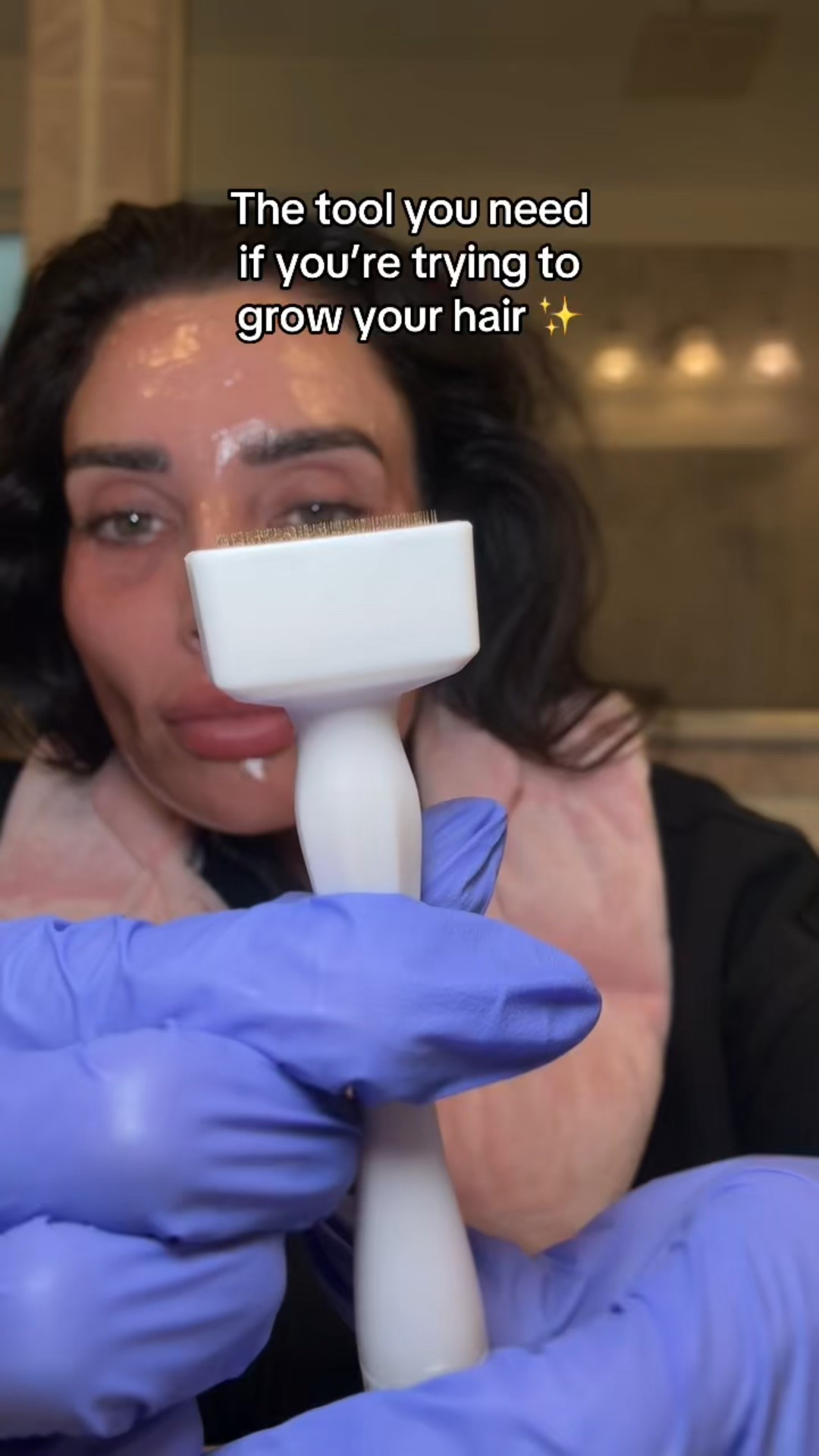The hair restoration tool you need

A derma stamp creates micro-channels that help your serums and peptides absorb deeper into the scalp for better results. Studies show 1.5 mm depth is ideal for hair restoration, and this one is adjustable — so you can safely use it on your scalp and skin.
It’s one of those under-$40 beauty tools that’s genuinely worth it.

#LTKBeauty #LTKFindsUnder50 #LTKFindsUnder100