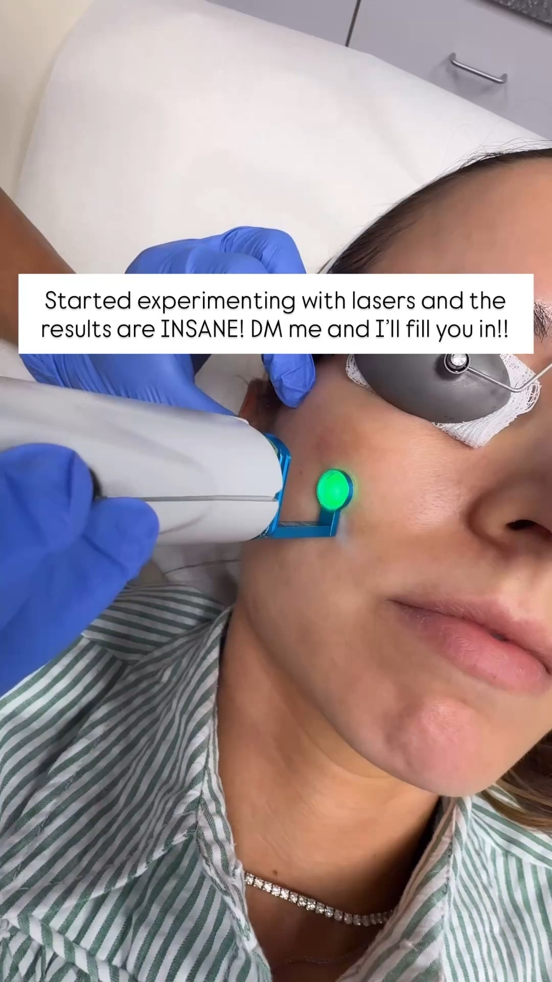 Aging backwards and here’s how! LASERS: I am currently trying to treat melasma and pigment issues. I have been doing VBeam (pulsed-dye laser) + Picoway (targets pigment) + Nordlys Frax 1940 (non-ablative fractional laser). Melasma is very difficult to treat, especially if it’s deep (which is the case with me). I anticipate I’ll need multiple sessions to get the results I’m after BUT I am super impressed with my overall skin texture and brightness since starting the laser treatments. These require minimal downtown and you can wear makeup after 48 hours. Your skin will slowly flake off within 7 days, revealing smoother and brighter skin! They will numb you - pain level is a 5 for me (definitely manageable). 

#LTKdayinmylife #LTKselfcare #LTKBeauty