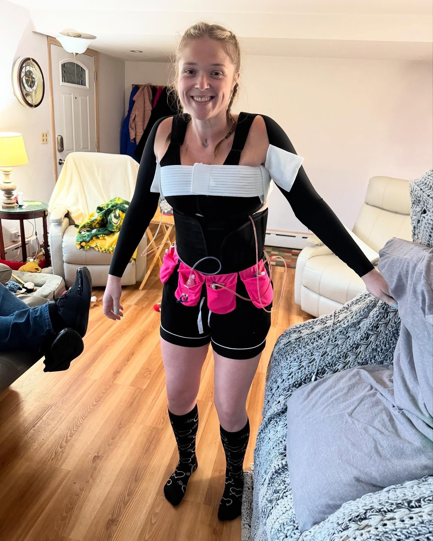 I’ve been told by many that “swell hell” starts on day 3/4 post op…..can confirm. I feel like a stuffed sausage. 
Pain is barely there though, just very swollen / tight. The worst part of this experience so far has been the itchiness. Benadryl is not even touching it😭