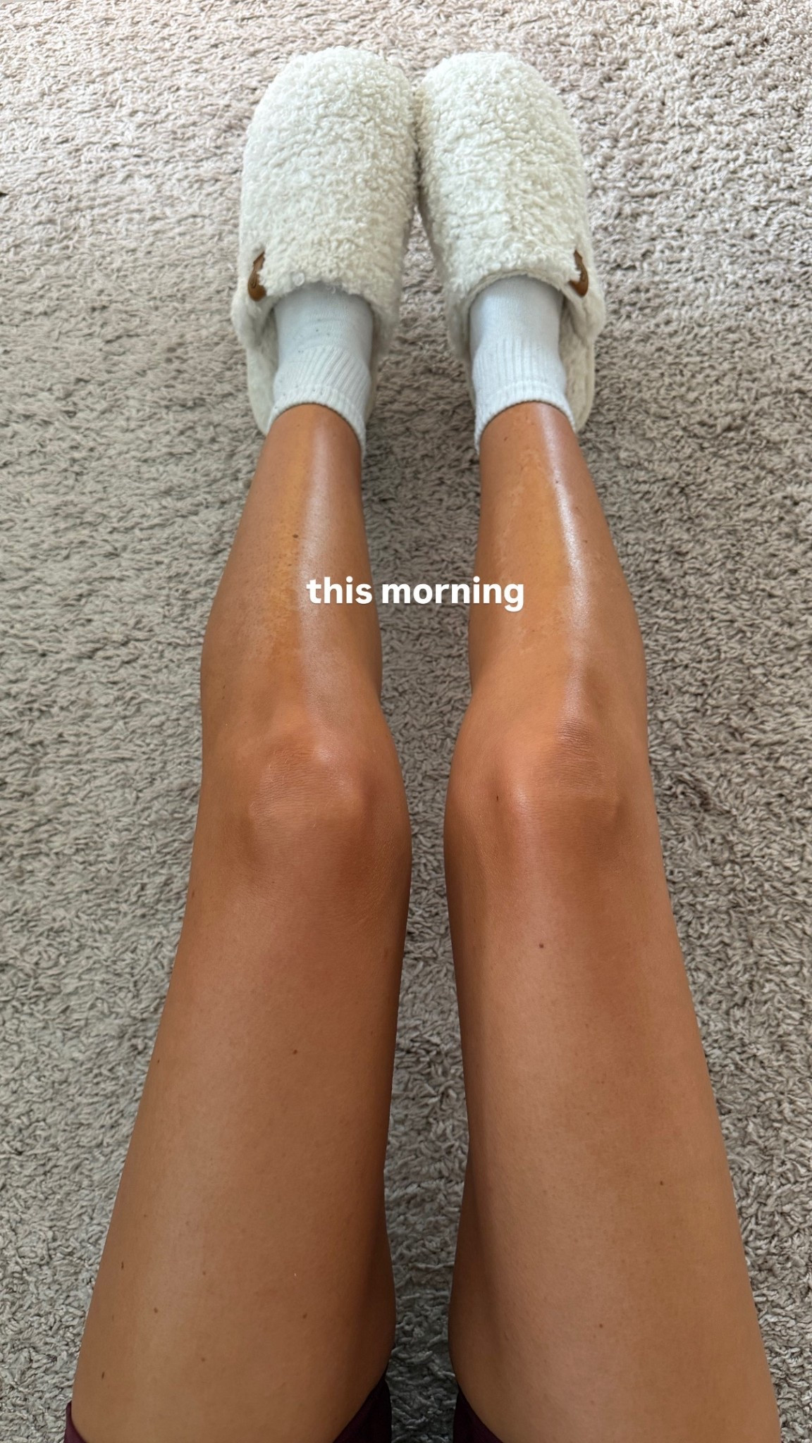 The 10 min tan results after a full 24 hours! For those of you who aren’t familiar, the concept of the product is that you can wash it off after 10 minutes, in immediately leaves you with a really pretty glow that continues to deepen over the next 6 to 8 hours, and then it is fully developed within 24! Truly such a hydrating pretty product that I’m still blown away by ￼

#LTKselfcare #LTKBeauty #LTKgrwm