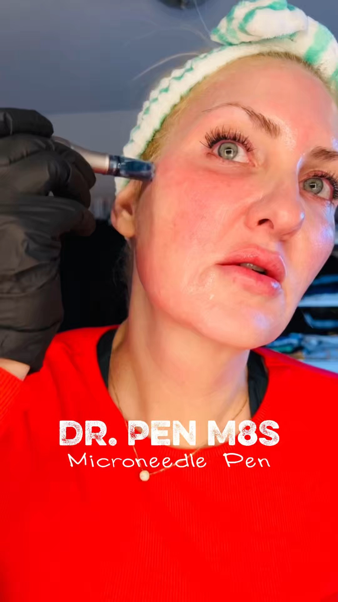 ✨Dr. Pen M8S—Get it while it’s available! Comes with the case, pen, & cartridges! It’s the full set! ✨

Microneedling triggers massive collagen, fades scars, shrinks pores, smooths wrinkles, and makes your skincare actually absorb. Glowy, bouncy skin in weeks — no derm visit needed!💕


#LTKOver40 #LTKBeauty #LTKselfcare