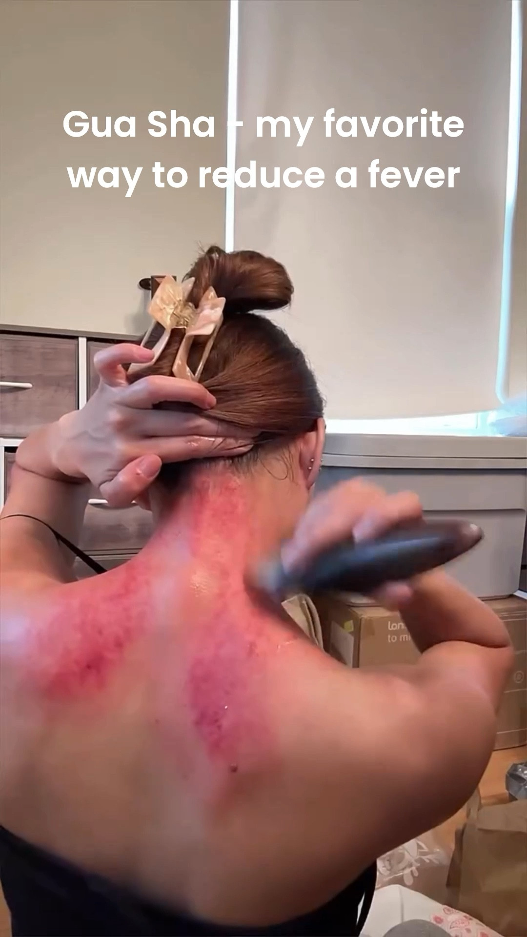 Every time I get the first signs of a fever, I start scraping. I’ve been doing this for years and it works every time. 🤝🏼 Traditional chinese medicine gua sha breaks the fever fast, gets rid of the annoying headaches that come with catching a cold, and speeds up the recovery process by supporting your immune system. It doesn’t hurt — it feels kind of like a deep tissue massage, very relaxing ❤️ Would you try this?

#guasha #bodyguasha #tcm #traditionalchinesemedicine
