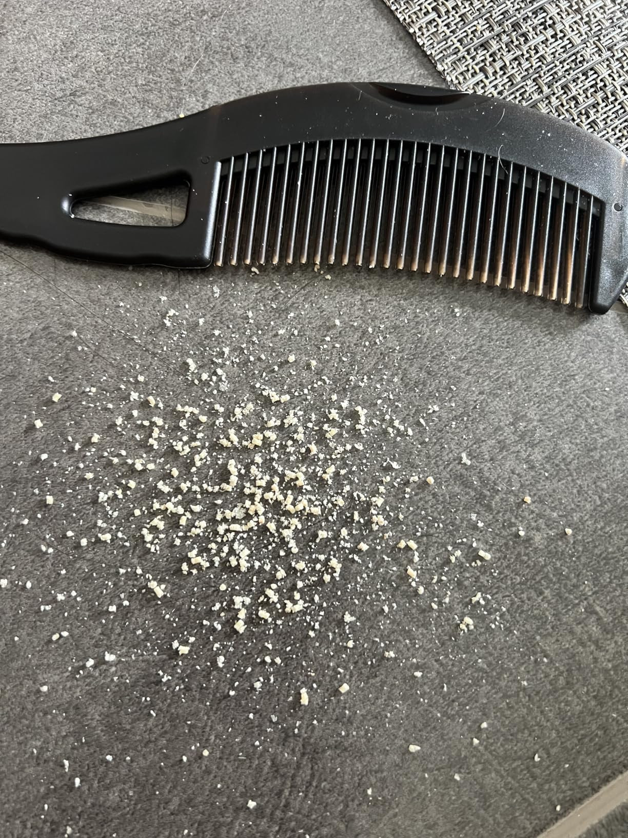 Dandruff Comb for Scalp Care - Multifunctional Hairbrush for Dandruff Removal, Detox & Psoriasis,... | Amazon (US)