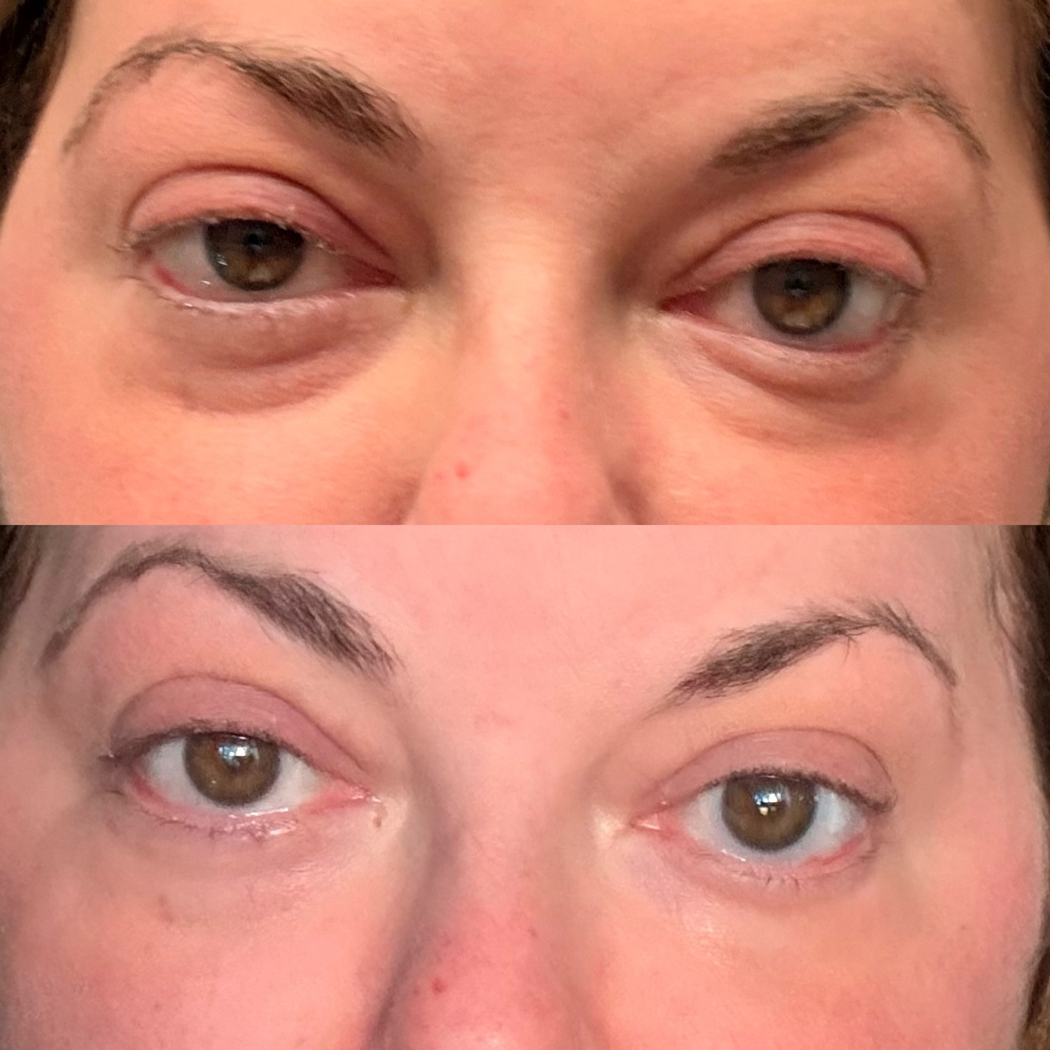 Before & After no filter Collagen Eye Patches - WOW 

#LTKgrwm #LTKselfcare #LTKdayinmylife