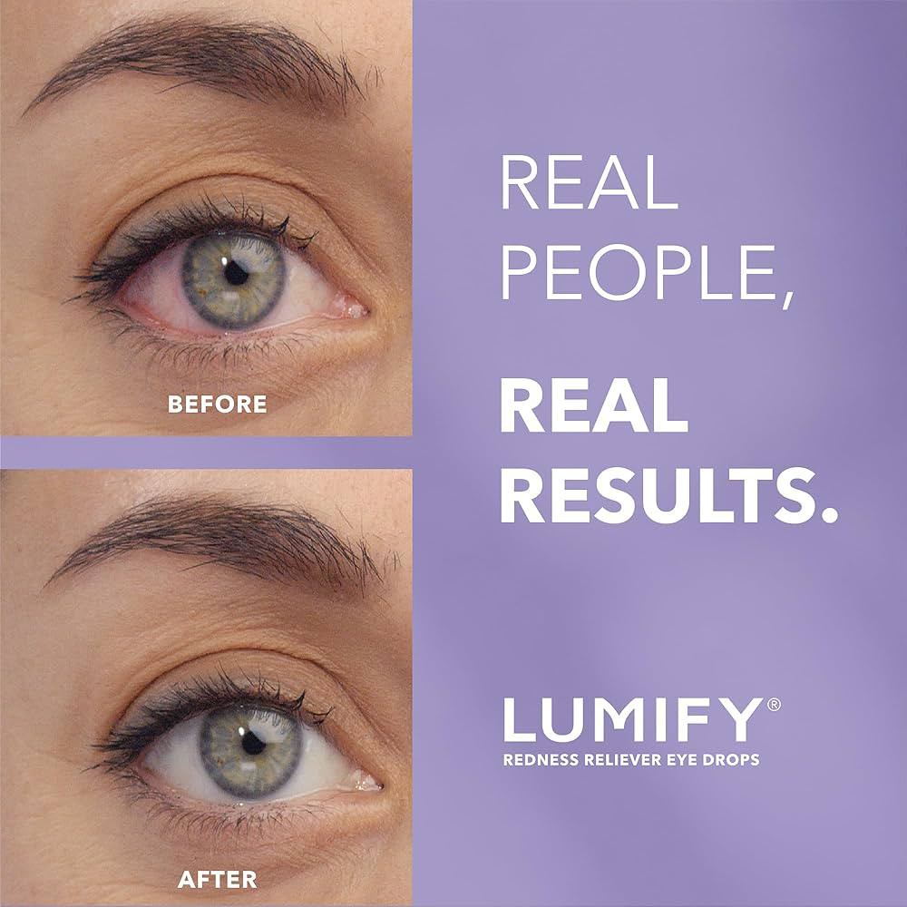 LUMIFY Eye Drops for Red Eyes, Redness Reliever for Brighter Looking Eyes, Works in 1 Minute & La... | Amazon (US)