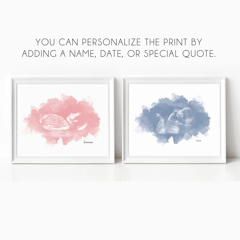 Watercolor Ultrasound Art Print, Baby Shower Gifts, Gender Reveal, Name Reveal, Sonogram Gifts, C... | Etsy (US)