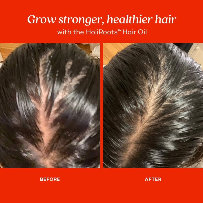 HoliRoots™ Pre-Wash Treatment Oil for Thinning Hair | Sephora (CA)