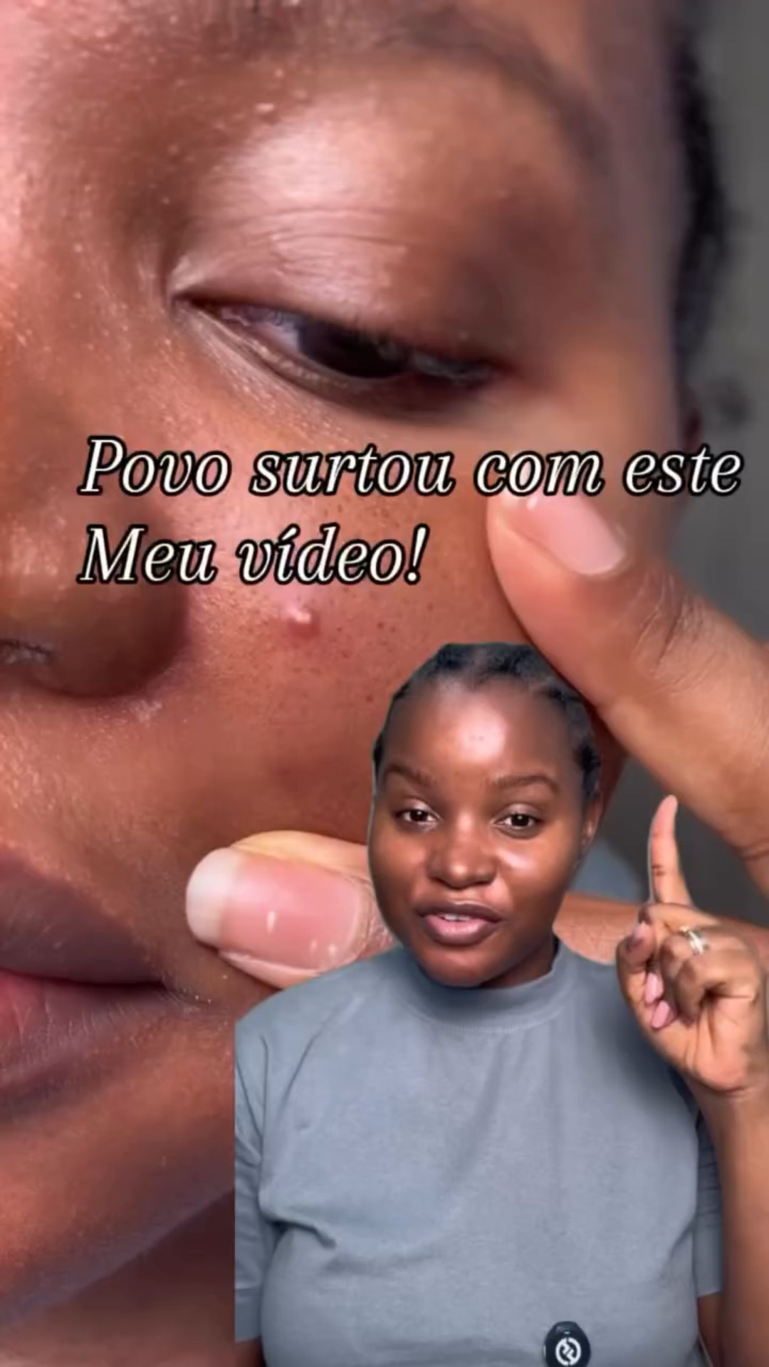 Conversa seria aqui hoje!

#skincare #tutorial #pelesaudavel #satisfaction #peleoleosa

#LTKbrasil #LTKbeleza