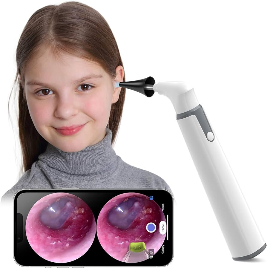 ScopeAround Otoscope with Light, Ear Camera with Dual View, 720pHD WiFi Ear Scope with 6 LED Ligh... | Amazon (US)