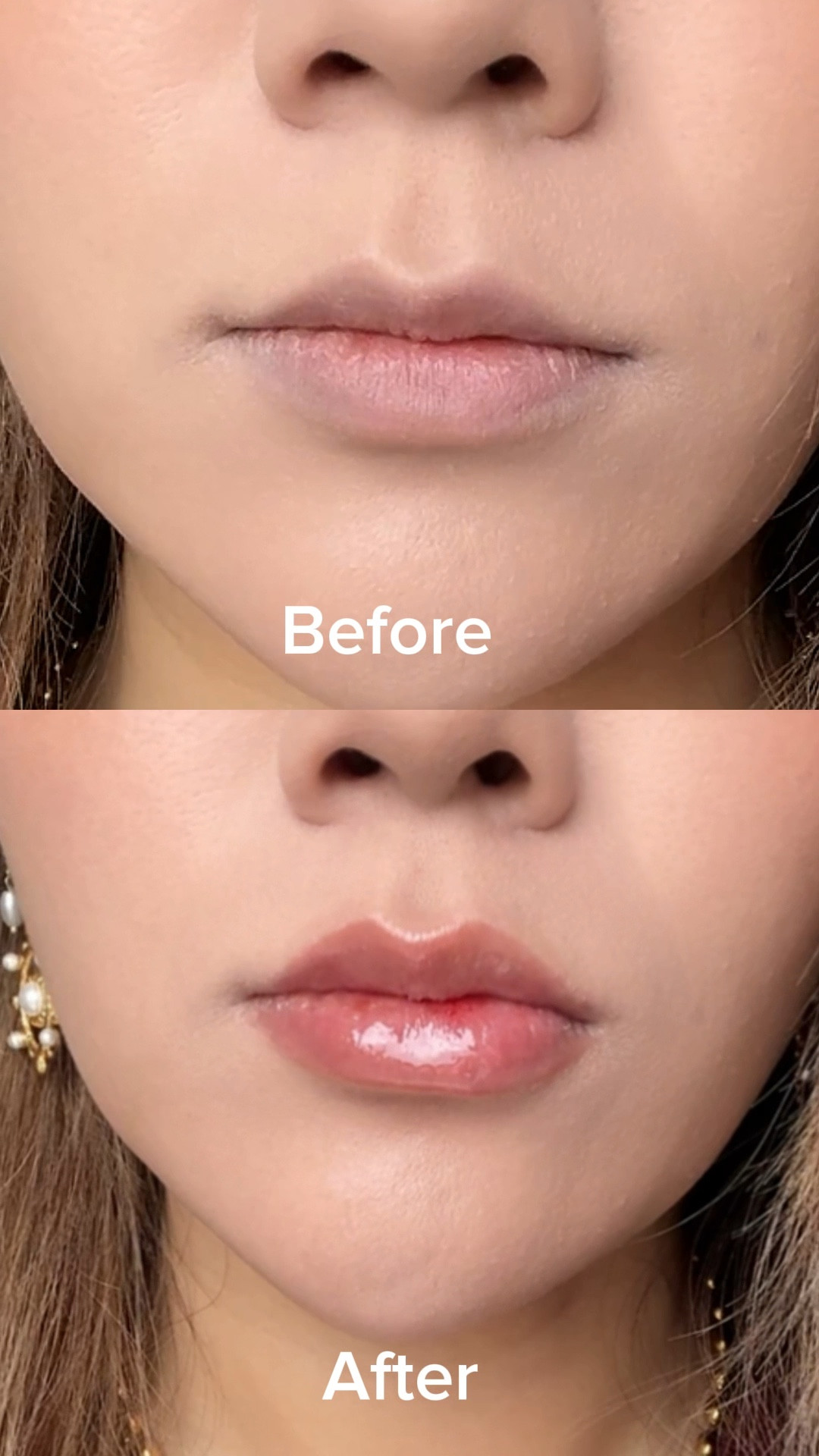 Who even needs lip filler?! 