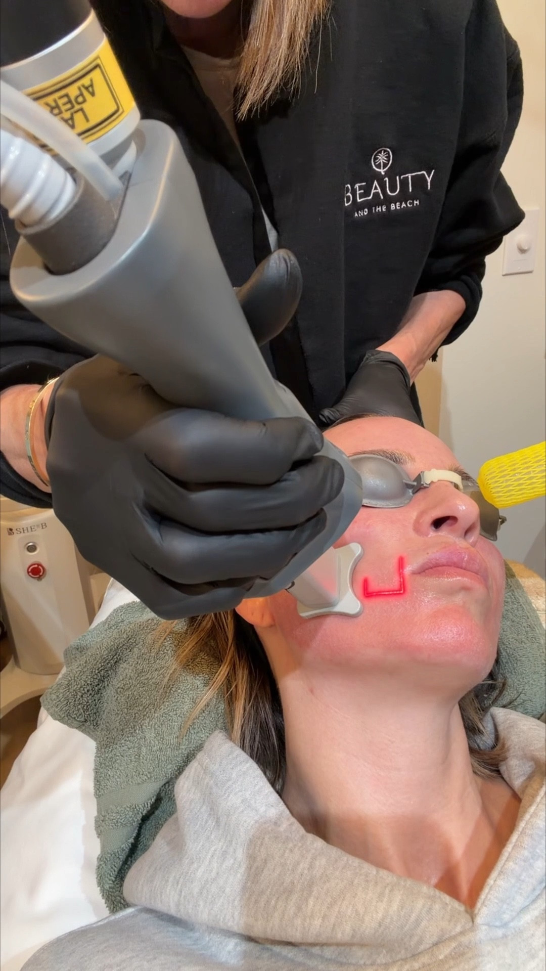 This is the fractionated CoolPeel.
It boosts collagen, smooths texture, softens fine lines, and refines pores — with way less downtime than traditional CO₂ lasers.

Because it’s fractionated, it treats the skin in tiny sections, which is why you’ll see redness at first and some light scabbing as your skin renews.

How often:
New to lasers? 1–2x a year.
I’m in maintenance mode, so once a year works for me.



#LTKBeauty #LTKdayinmylife #LTKOver40