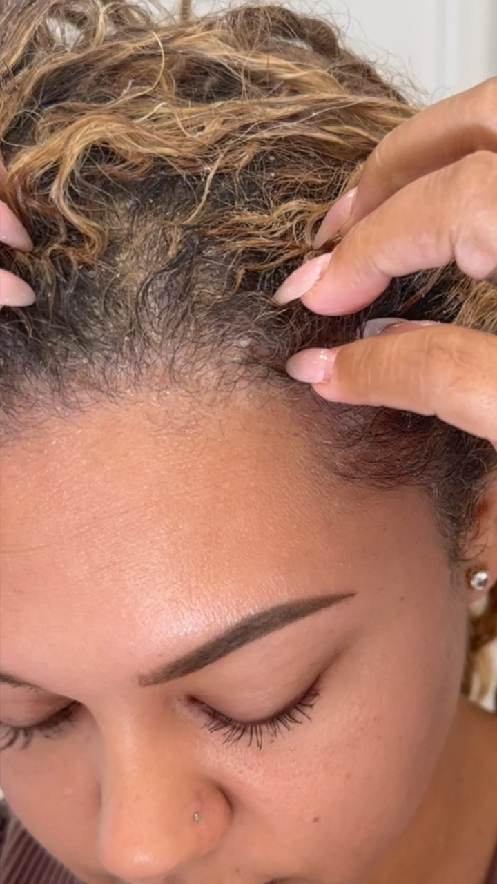 Hello beautiful! 

My scalp has always given me issues but lately I’ve found some products that have made all the difference in the world. 

Hope this helps! 

#LTKxTarget #LTKbeauty