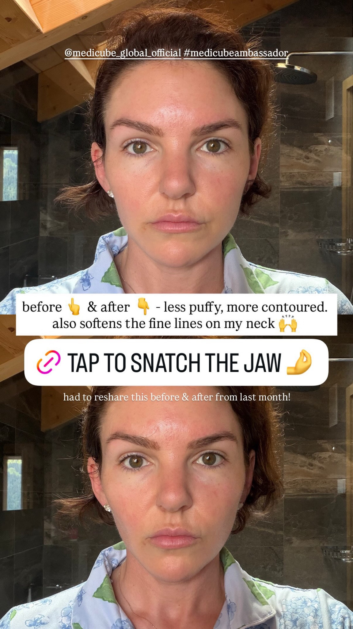 before & after - less puffy, more contoured.
also softens the fine lines on my neck

#LTKselfcare #LTKBeauty