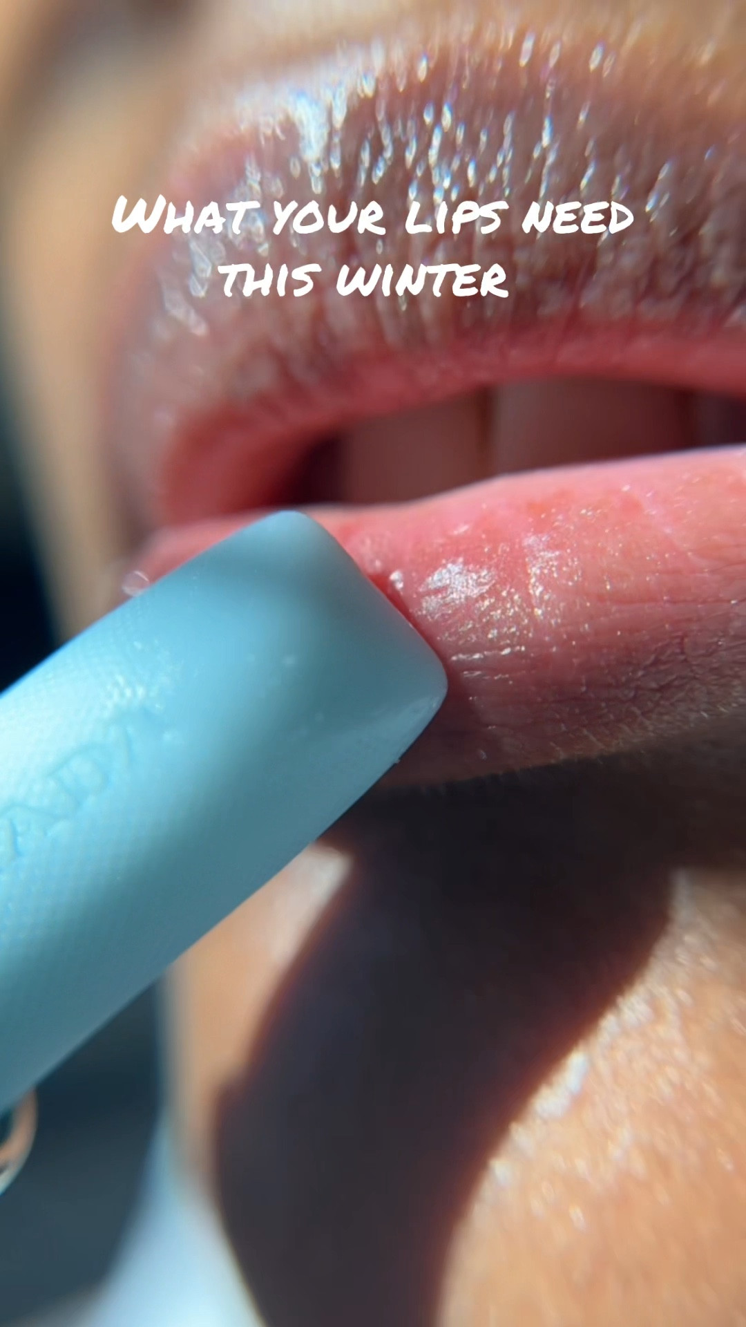 What your lips need this winter since we don’t do cracked or dry lips #pradabalm #lipbalm 

#LTKSeasonal #LTKBeauty