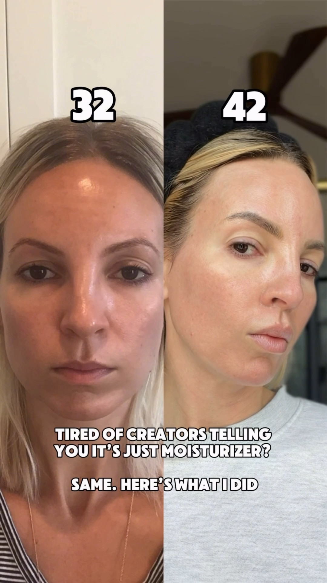 i’m 42. and i’ll never tell you something that isn’t true — good skin takes work. here’s exactly what i did

-tretinoin (4x/week — less if my skin gets irritated)
-vitamin c every morning
-niacinamide every morning
-spf (every single day — non-negotiable)
-co2 laser (2x/year)
-microneedling + growth factors (about 4x/year)
-at-home skin stamping (1x/week with a high-quality growth factor)
-sculptra (to build collagen over time)
-red light therapy (most days — i spray a green tea mist first to boost results)
-exfoliation (2x/week — one physical exfoliant, one chemical)
-skin flooding (layers of hydration on damp skin)
-barrier-first skincare (i don’t mess this up anymore)
-hormone balance (I do bioidentical hormone therapy)
-ingested hyaluronic acid
-high protein intake
-a shot of high-polyphenol olive oil daily
-a ridiculous amount of water
-sleep (i track it — it matters more than you want it to)


#LTKBeauty #LTKOver40 #LTKselfcare