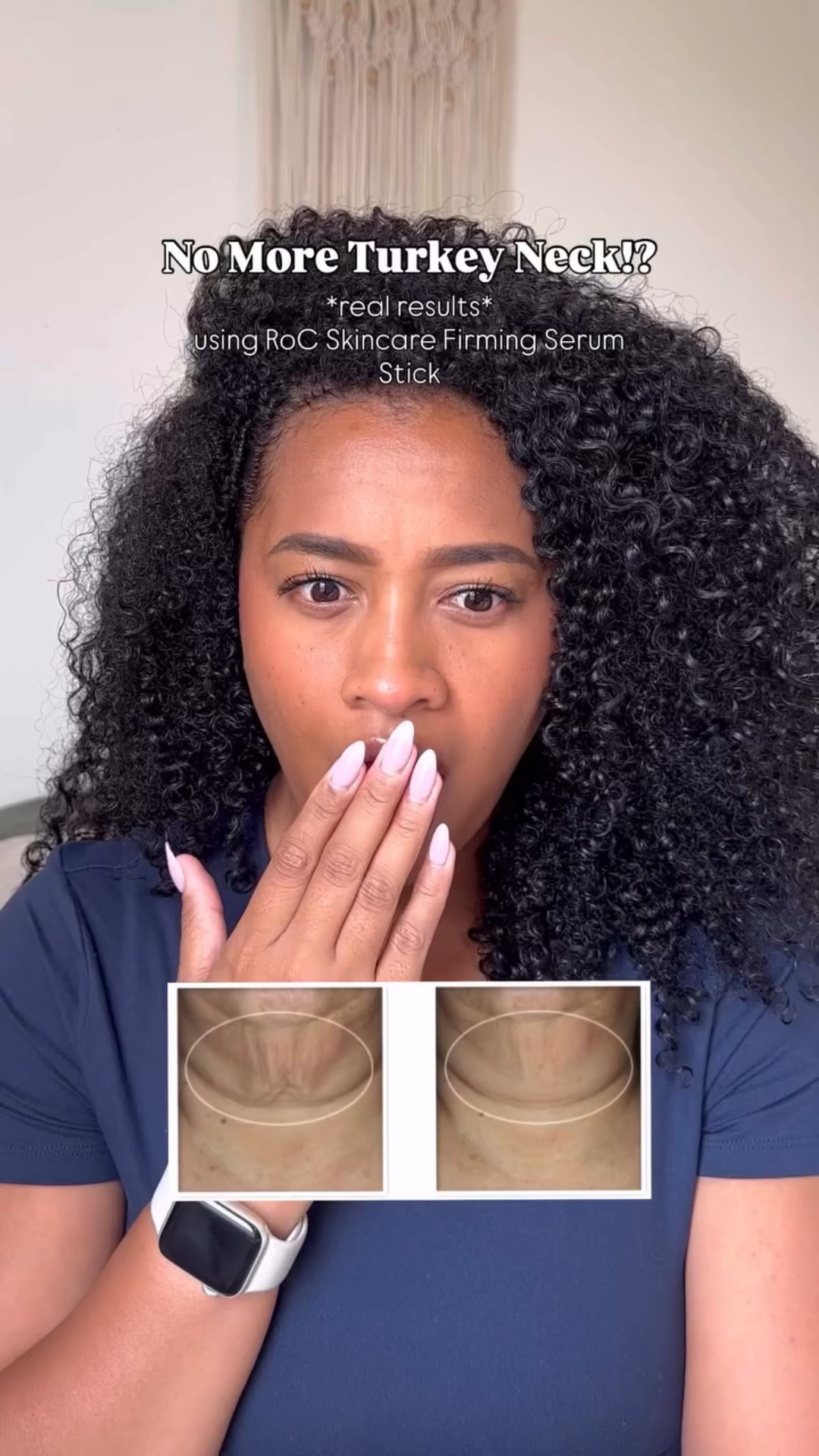 Comment SKIN and I’ll dm you the link to the magic stick 😆 @rocskincare ‘s new Firming Serum Stick is a non-invasive, pain free affordable solution under $30 for wrinkles, turkey neck, and all around firmer skin! ✨

#roc_partner #rocskincare #retinol #dermstick