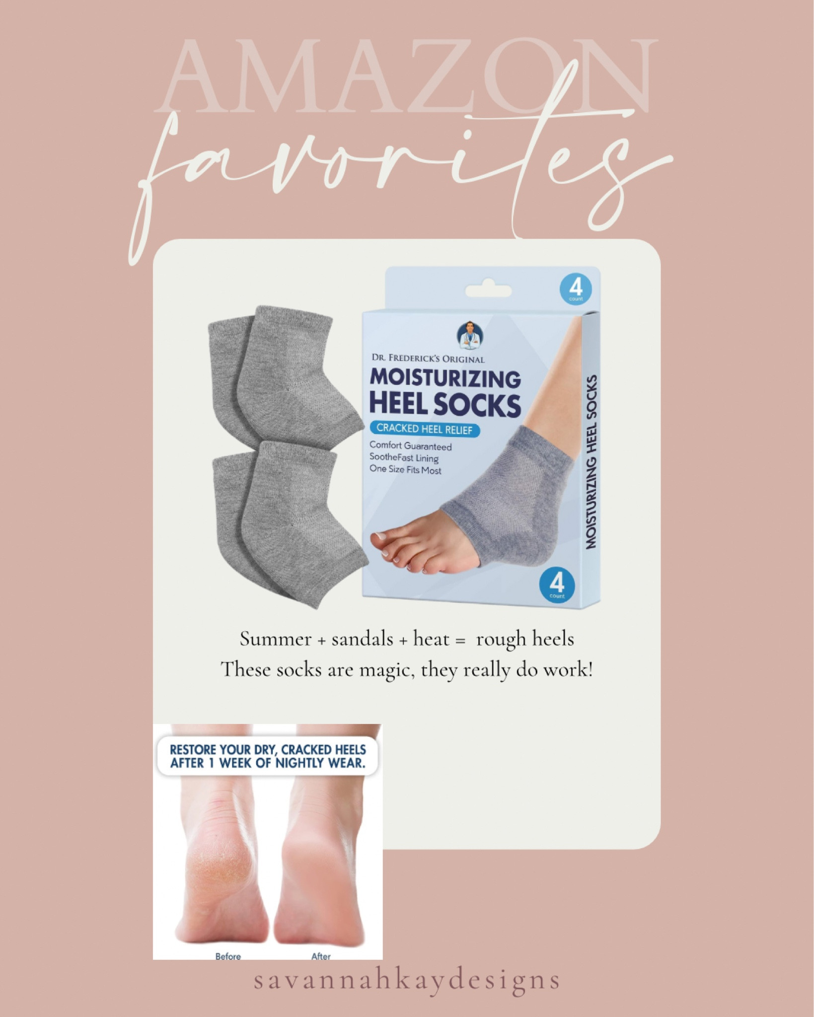 Summer is in full swing and flip flops and all the sandals do all sorts of things to my heels! Sliding these on every day has helped so much! #feet #care #socks 

#LTKunder50 #LTKshoecrush #LTKbeauty