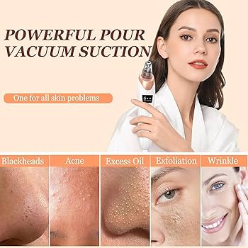 Blackhead Remover Vacuum 3 Suction Power Mode Blackhead Remover Tool with 5 Suction Heads Blackhe... | Amazon (UK)