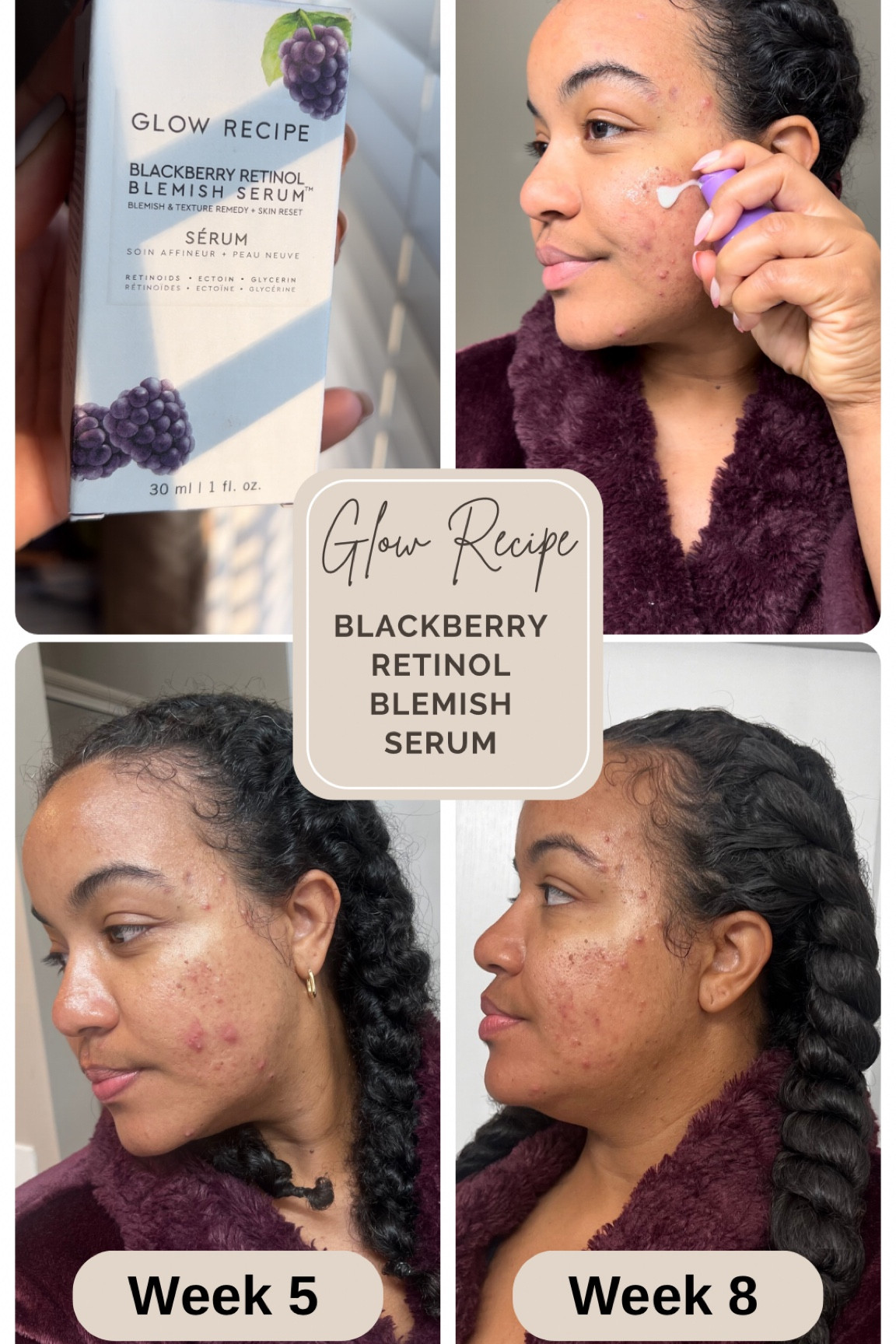New glow recipe product, retinol serum, acne prone skincare, skincare for acne, glow recipe skincare, best skincare for acne, blemish control skincare, nighttime serum 

#LTKFindsUnder50 #LTKBeauty