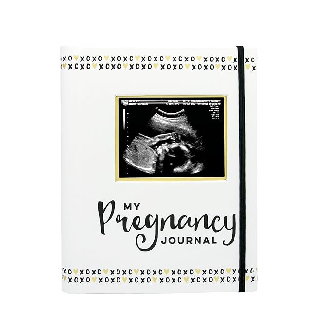 Pearhead My Pregnancy Journal, Pregnancy Keepsake Book, Pregnancy Milestone Memories and Photo Al... | Amazon (US)