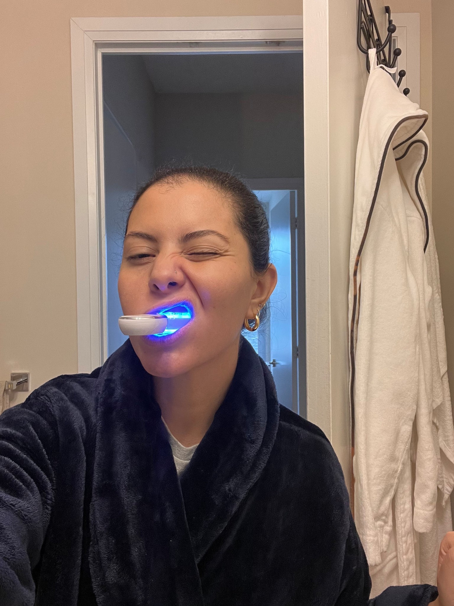 Whitening gel + blue light 🦋 #whiteningstrips #teethwhitening #amazonshopping #amazonesseltials #amazonbeauty #amazonprime 

#LTKbeauty #LTKgiftguide #LTKcanada
