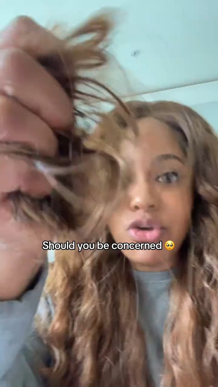 When should you be worried @TerraHealth Essentials #hairshedding #hairloss #hairstyle 

 #LTKselfcare #LTKSaleAlert #LTKBeauty