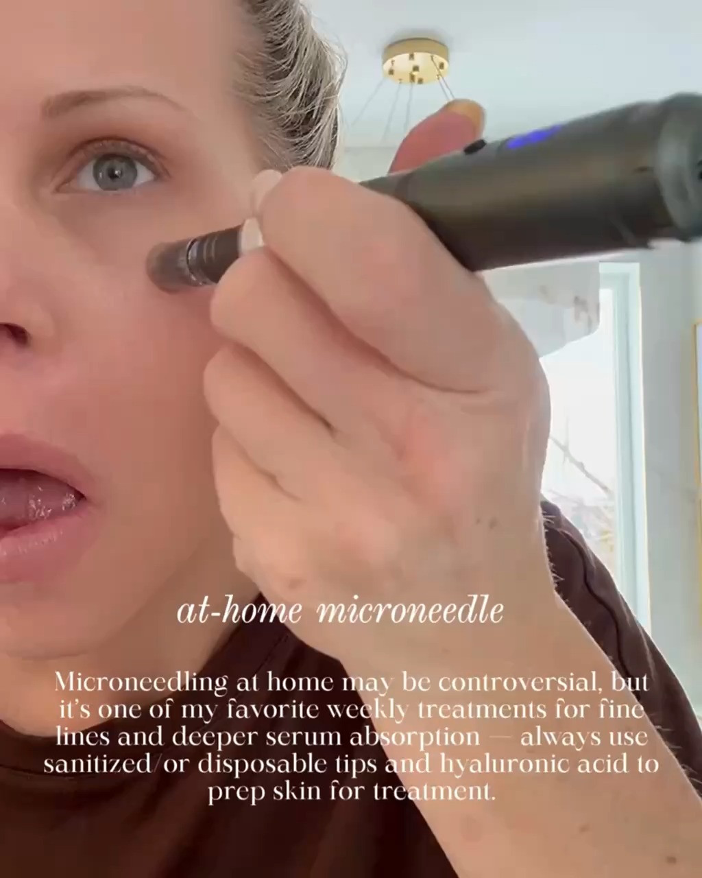 AT HOME MICRONEEDLE PEN FOR SKIN TEXTURE AND SERUM ABSORPTION!

This at home microneedle pen is one of my favorite weekly skincare tools when I want smoother looking skin and better product absorption. I use it with a simple hydrating serum to prep the skin and always stick to sanitized or disposable tips. When done thoughtfully and gently, it fits seamlessly into my routine.

#Amazon #TheHillaryStyle #MicroneedlePen #SkincareTools #AtHomeSkincare #SkincareRoutine #MatureSkinCare #BeautyDevices 

 #LTKmomlife #LTKmorningroutine #LTKOver40