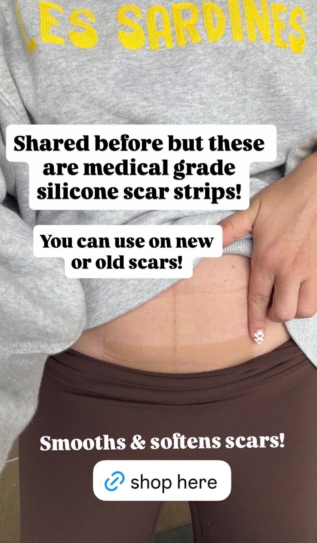 Medical grade silicone scar strips!! These are great for smoothing and softening scars

#LTKBump #LTKselfcare #LTKBeauty
