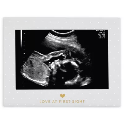 Little Blossoms by Pearhead "Love at First Sight" Sonogram Frame in Grey | Bed Bath & Beyond