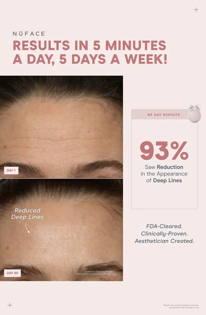 MINI+ On-the-Go Facial Toning Starter Kit $309 Value | Nordstrom