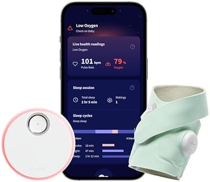 Dream Sock – Smart Wearable Baby Monitor, Infant Pulse Oximeter Tracks Oxygen & Heart Rate | Pa... | Amazon (US)