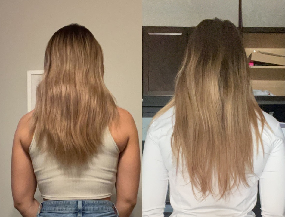 My 4 month Nutrafol progress!