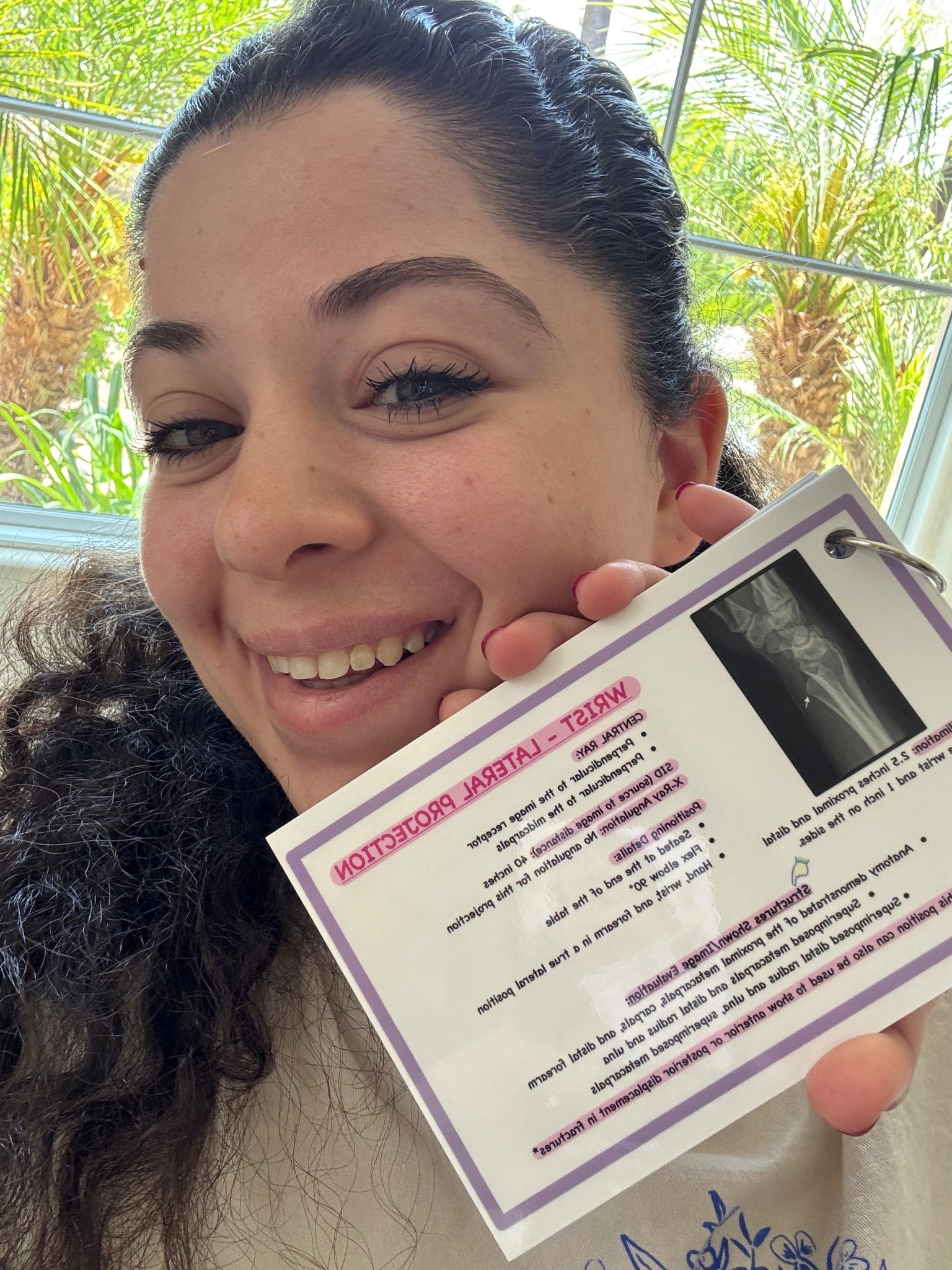 Radiography flashcards from Etsy - Upper extremity 

#LTKWorkwear #LTKU #LTKSaleAlert