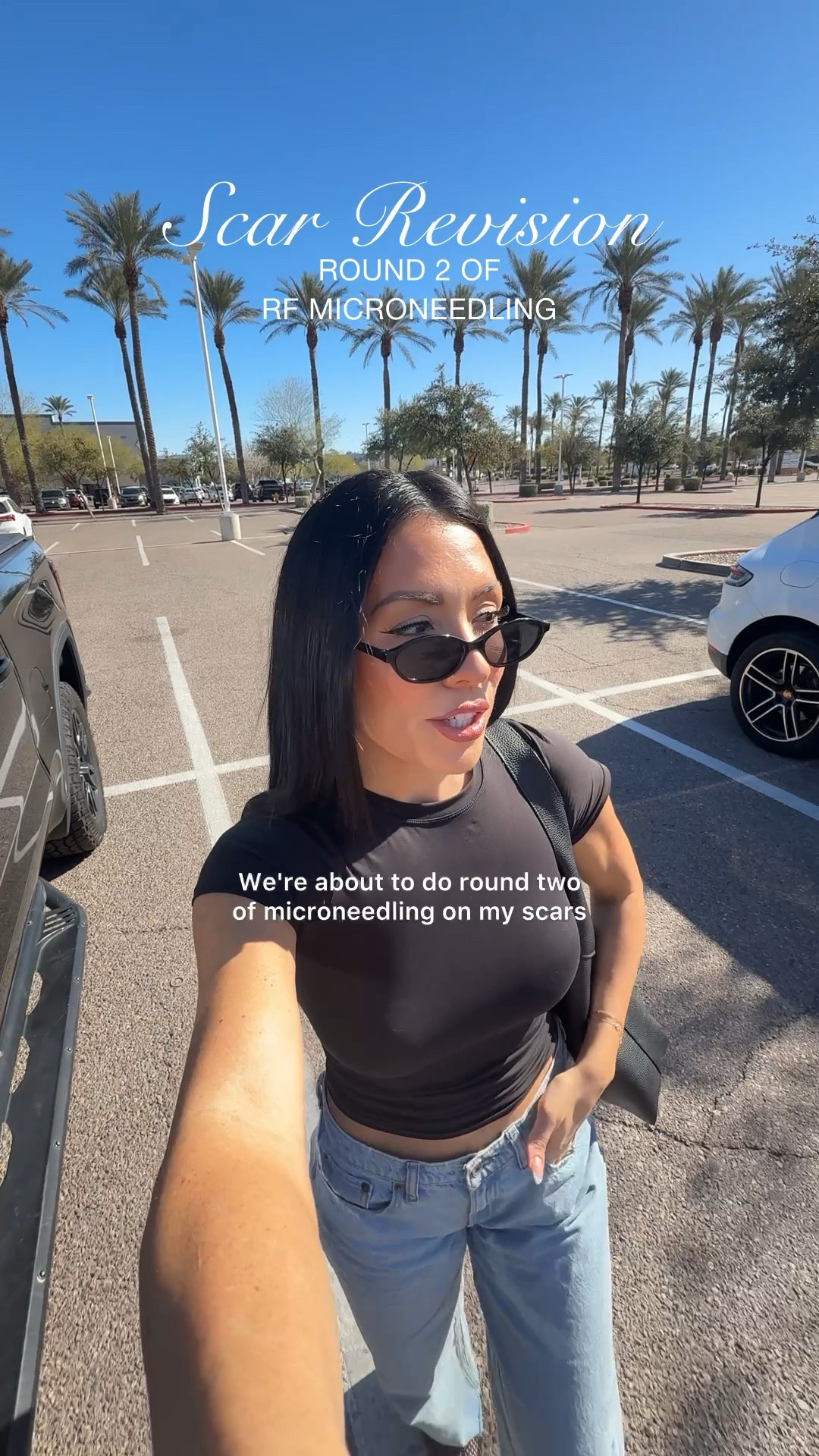 Sharing a scar update on the feed! Sharing what I wore in this reel 

Abercrombie top size XS 
Abercrombie jeans size 25 

Women’s Amazon glasses 


#LTKstorytime #LTKdayinmylife #LTKmorningroutine