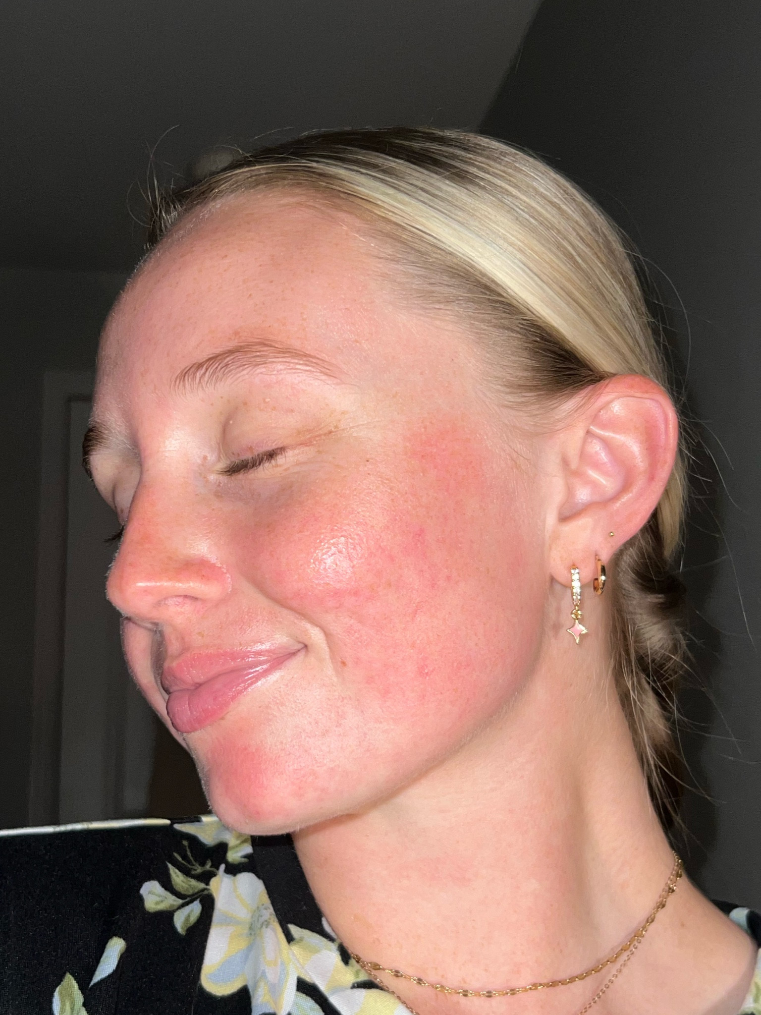 Night time skincare (for acne prone skin )🌙🧴🫧

#LTKxSephora