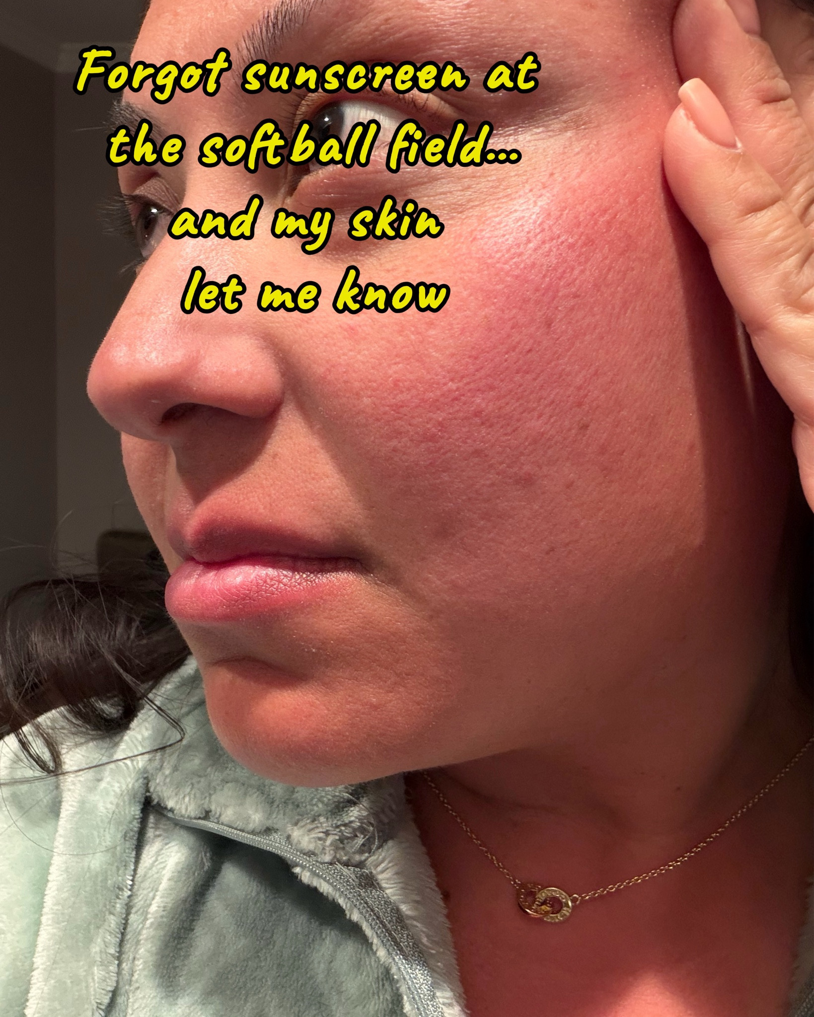 Spent the day at the softball field, forgot sunscreen, and my skin definitely let me know. My cheeks were red, hot, and irritated, so I kept things simple tonight and reached for First Aid Beauty Ultra Repair Cream as a soothing step. Sharing this in case anyone else needs a gentle post-sun skincare pick for sensitive skin.
#LTKbeauty #LTKfinds #FirstAidBeauty #sensitiveskin #postsunskincare #skincareroutine #sunburnrelief

#LTKselfcare #LTKBeauty