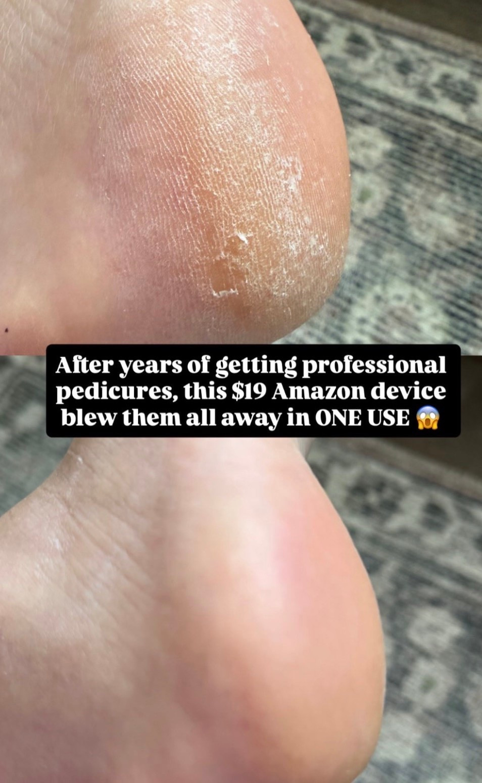 After years of getting professional pedicures, this under $20 pedicure tool from Amazon blew my mind! 😱

#LTKselfcare #LTKBeauty