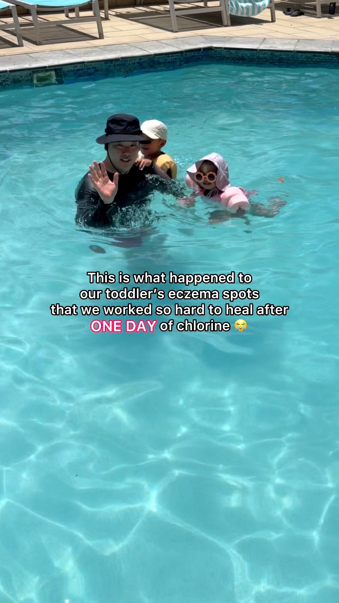 Korean eczema cream that we LOVE will be on Amazon prime from June 23- June 26!

#LTKSaleAlert #LTKSwim #LTKKids