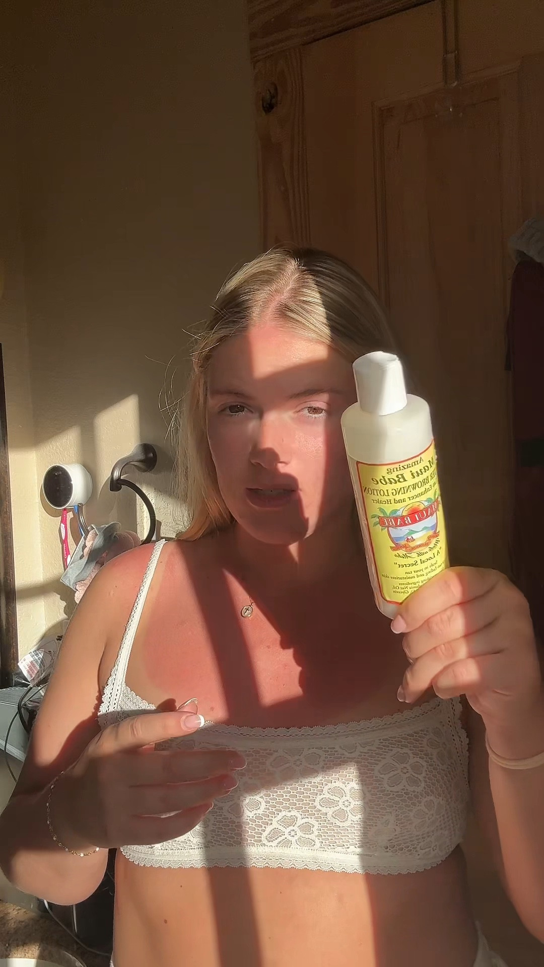 post sunburn lotion! 
