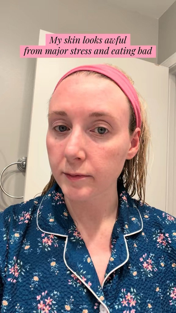 Using the lush coffee mask to bring my skin back to life #lush #lushcoffeemask #lushproducts #skincare #masks 


#LTKBeauty #LTKselfcare #LTKdayinmylife