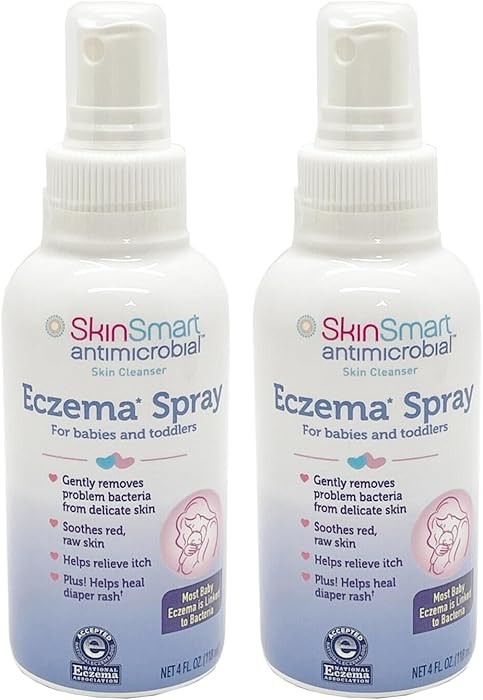 SkinSmart Eczema Spray for Babies and Toddlers, Removes Bacteria so Skin Can Heal, 4 Ounce Spray ... | Amazon (US)